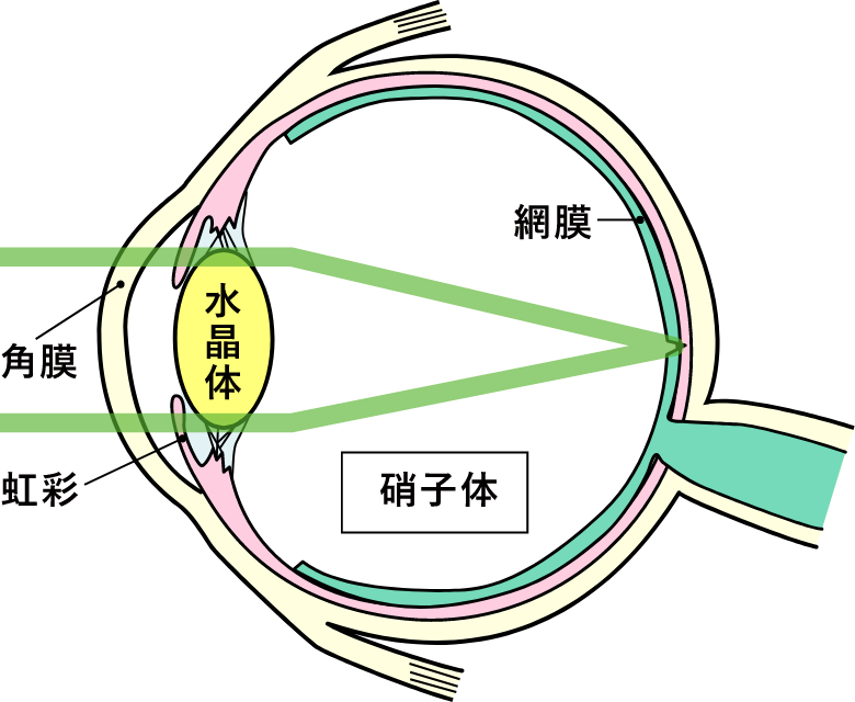 正常な眼